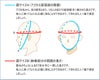 「旭峰(きょくほう)」6mm織刺具の目刺 剣道防具セット
